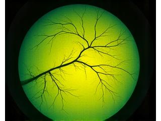 Image d'angiographie fluorescéine oculaire.