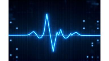 Imagerie cardiaque avec superpositions IA pour la détection d'anomalies d'ECG automatiques.